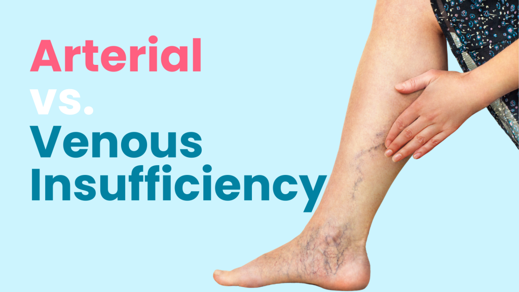 Which Action Would Aggravate the Clinical Manifestations of Venous Insufficiency