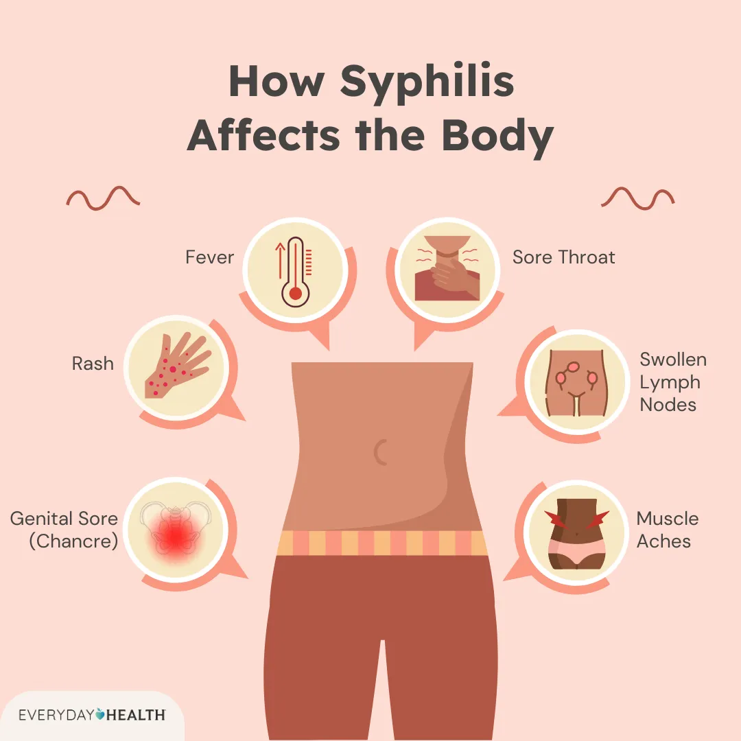 Which Manifestation Indicates Tertiary Syphilis: Key Signs